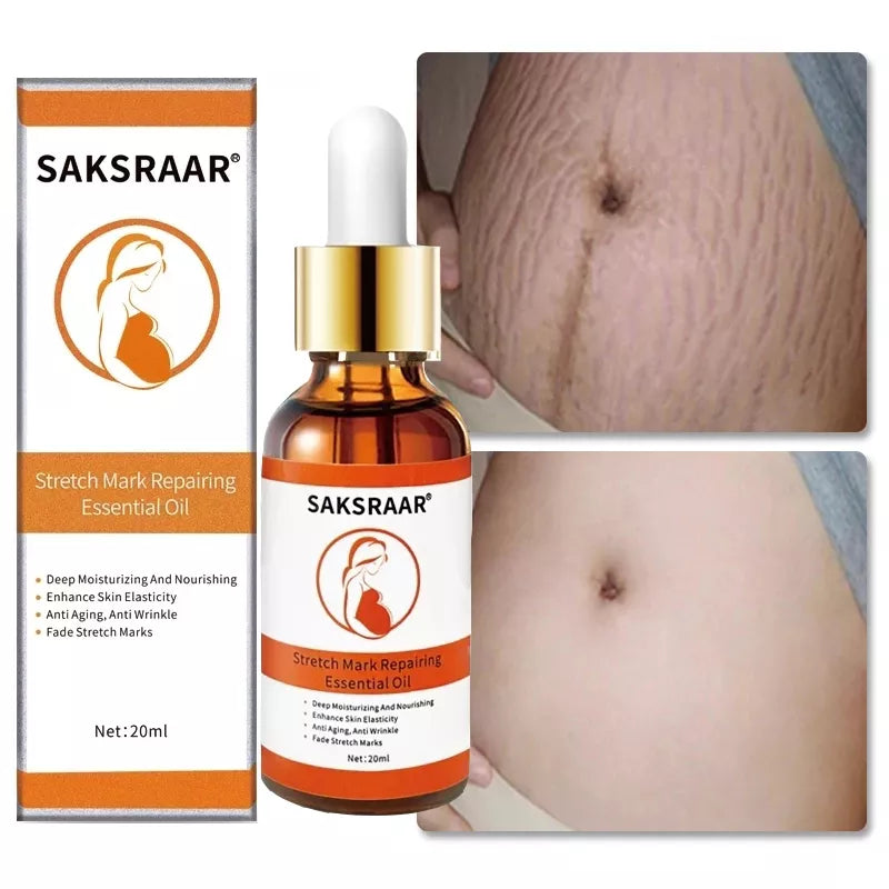 Silken Radiance: Stretch Marks Remover Cream and Essential Oil Duo for Maternal Skincare 